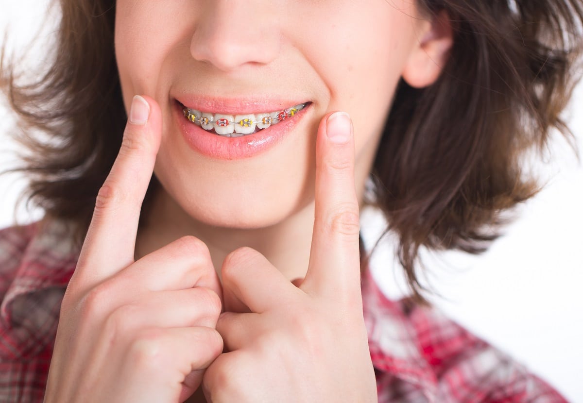 Orthodontist In Lexington, Sc