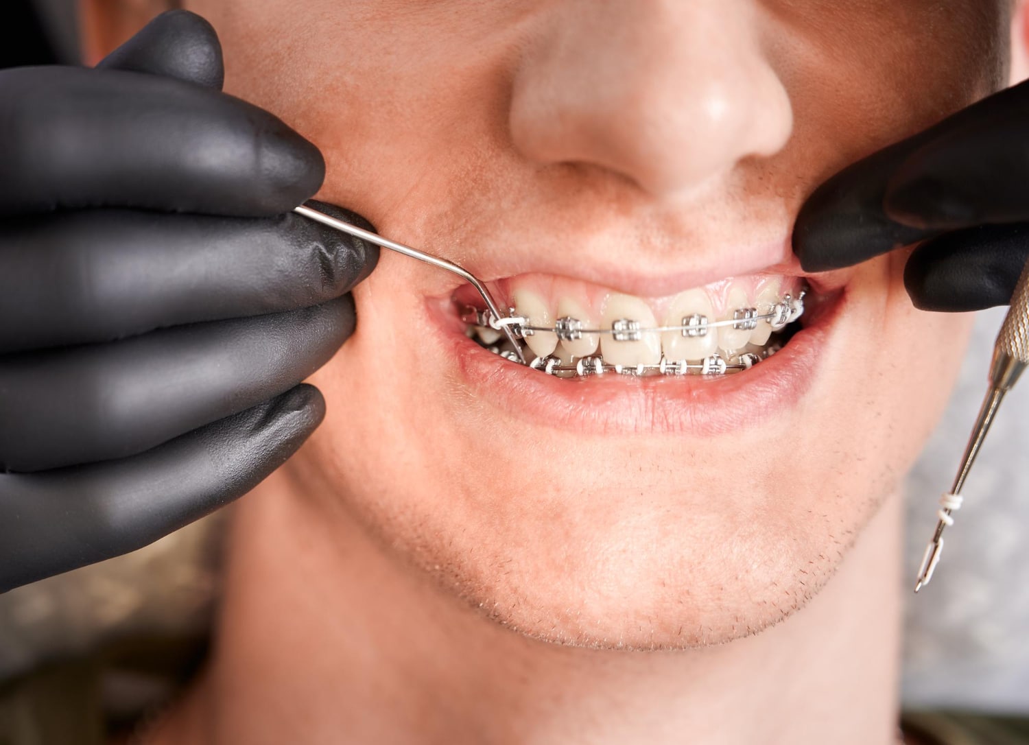 Orthodontist In Newberry