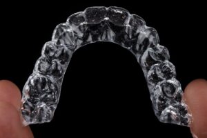 Invisalign Braces