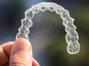 Invisalign Teen